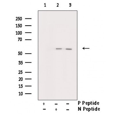 AF3074 staining Mv1Lu cells treated with hydroxyurea(20 mM,16h) by ICC/IF. Cells were fixed with PFA and permeabilized in 0.1% saponin prior to blocking in 10% serum for 45 minutes at 37¡ãC. The primary antibody was diluted 1/400 and incubated with the sample for 1 hour at 37¡ãC. A  Alexa Fluor? 594 conjugated goat polyclonal to rabbit IgG (H+L), diluted 1/600 was used as secondary antibod