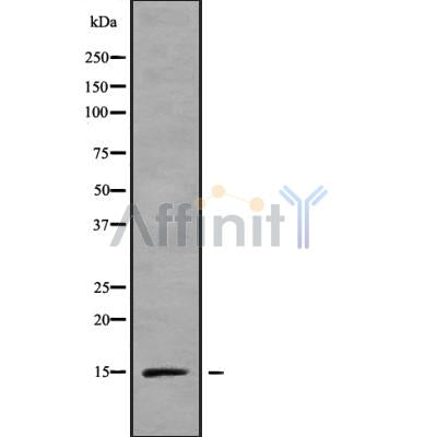 Western blot analysis of RPS15A using LOVO whole cell lysates