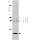 Western blot analysis of RPS17 using Jurkat whole cell lysates