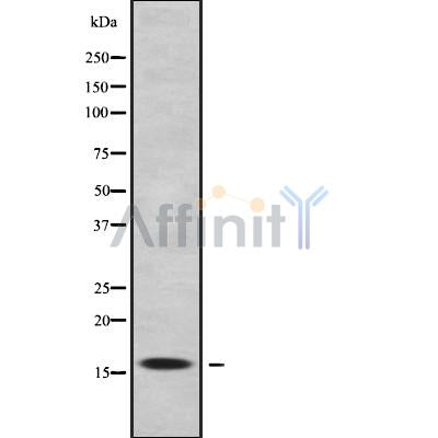Western blot analysis of RPS17 using Jurkat whole cell lysates