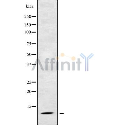 Western blot analysis of RPS21 using Jurkat whole cell lysates