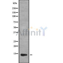 Western blot analysis of RPLP1 using COLO205 whole cell lysates