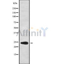 Western blot analysis of RPL13A using COS7 whole cell lysates