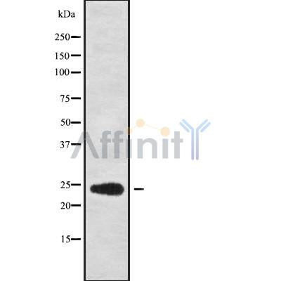 Western blot analysis of RPL13A using COS7 whole cell lysates