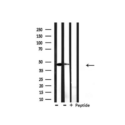 Western blot analysis of extracts from HepG2, mouse spleen , using Keratin 18 Antibody.