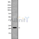 DF9127 at 1/100 staining Human prostate tissue by IHC-P. The sample was formaldehyde fixed and a heat mediated antigen retrieval step in citrate buffer was performed. The sample was then blocked and incubated with the antibody for 1.5 hours at 22¡ãC. An HRP conjugated goat anti-rabbit antibody was used as the secondary