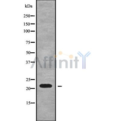DF9127 at 1/100 staining Human prostate tissue by IHC-P. The sample was formaldehyde fixed and a heat mediated antigen retrieval step in citrate buffer was performed. The sample was then blocked and incubated with the antibody for 1.5 hours at 22¡ãC. An HRP conjugated goat anti-rabbit antibody was used as the secondary