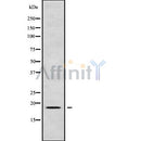 Western blot analysis of extracts from various samples, using RPL24 Antibody.
 Lane 1: Mouse Myeloma cell treated with blocking peptide.
 Lane 2: Mouse Myeloma cell;
 Lane 3: Hela;
 Lane 4: huvel;
 