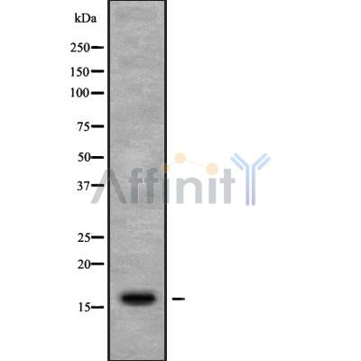 Western blot analysis of RPL27 using COLO205 whole cell lysates