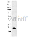 Western blot analysis of extracts from various samples, using RPL29 Antibody.
 Lane 1: Mouse Myeloma cell treated with blocking peptide.
 Lane 2: Mouse Myeloma cell;
 Lane 3: Hela;
 