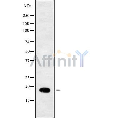 Western blot analysis of extracts from various samples, using RPL29 Antibody.
 Lane 1: Mouse Myeloma cell treated with blocking peptide.
 Lane 2: Mouse Myeloma cell;
 Lane 3: Hela;
 