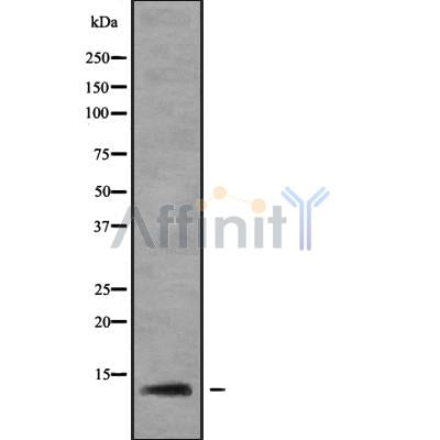 Western blot analysis of extracts from Rat spleen, using RPL37 Antibody. Lane 1 was treated with the blocking peptide.