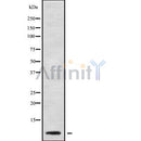 Western blot analysis of RPL41 using Jurkat whole cell lysates