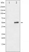 AF3077 staining MDA-MB-435 by IF/ICC. The sample were fixed with PFA and permeabilized in 0.1% Triton X-100,then blocked in 10% serum for 45 minutes at 25¡ãC. The primary antibody was diluted at 1/200 and incubated with the sample for 1 hour at 37¡ãC. An  Alexa Fluor 594 conjugated goat anti-rabbit IgG (H+L) Ab, diluted at 1/600, was used as the secondary antibod