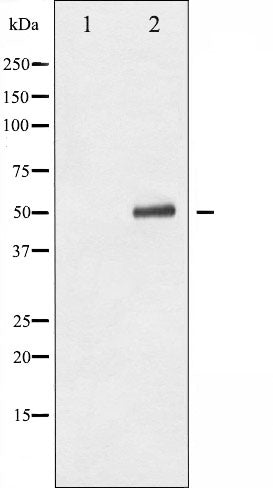 AF3077 staining MDA-MB-435 by IF/ICC. The sample were fixed with PFA and permeabilized in 0.1% Triton X-100,then blocked in 10% serum for 45 minutes at 25¡ãC. The primary antibody was diluted at 1/200 and incubated with the sample for 1 hour at 37¡ãC. An  Alexa Fluor 594 conjugated goat anti-rabbit IgG (H+L) Ab, diluted at 1/600, was used as the secondary antibod