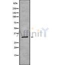Western blot analysis of RPL7A using K562 whole cell lysates