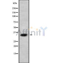 Western blot analysis of ABHD10 using 293 whole cell lysates