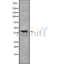 Western blot analysis of extracts from Mouse brain, using ABHD13 Antibody. Lane 1 was treated with the blocking peptide.