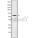 Western blot analysis of extracts from Mouse muscle, using CHRNG Antibody. Lane 1 was treated with the blocking peptide.