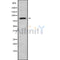 DF9145 at 1/100 staining Human brain cancer tissue by IHC-P. The sample was formaldehyde fixed and a heat mediated antigen retrieval step in citrate buffer was performed. The sample was then blocked and incubated with the antibody for 1.5 hours at 22¡ãC. An HRP conjugated goat anti-rabbit antibody was used as the secondary