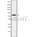 DF9146 at 1/100 staining Human liver cancer tissue by IHC-P. The sample was formaldehyde fixed and a heat mediated antigen retrieval step in citrate buffer was performed. The sample was then blocked and incubated with the antibody for 1.5 hours at 22¡ãC. An HRP conjugated goat anti-rabbit antibody was used as the secondary