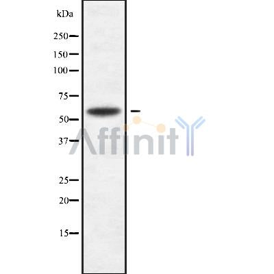 DF9146 at 1/100 staining Human liver cancer tissue by IHC-P. The sample was formaldehyde fixed and a heat mediated antigen retrieval step in citrate buffer was performed. The sample was then blocked and incubated with the antibody for 1.5 hours at 22¡ãC. An HRP conjugated goat anti-rabbit antibody was used as the secondary