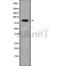 DF9147 staining HepG2 by IF/ICC. The sample were fixed with PFA and permeabilized in 0.1% Triton X-100,then blocked in 10% serum for 45 minutes at 25¡ãC. The primary antibody was diluted at 1/200 and incubated with the sample for 1 hour at 37¡ãC. An  Alexa Fluor 594 conjugated goat anti-rabbit IgG (H+L) Ab, diluted at 1/600, was used as the secondary antibod