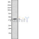 DF9150 at 1/100 staining Mouse colon tissue by IHC-P. The sample was formaldehyde fixed and a heat mediated antigen retrieval step in citrate buffer was performed. The sample was then blocked and incubated with the antibody for 1.5 hours at 22¡ãC. An HRP conjugated goat anti-rabbit antibody was used as the secondary