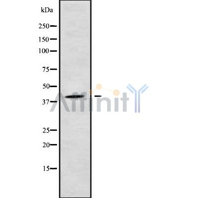 DF9150 at 1/100 staining Mouse colon tissue by IHC-P. The sample was formaldehyde fixed and a heat mediated antigen retrieval step in citrate buffer was performed. The sample was then blocked and incubated with the antibody for 1.5 hours at 22¡ãC. An HRP conjugated goat anti-rabbit antibody was used as the secondary