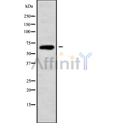 Western blot analysis of extracts from 293, using ACBD5 Antibody. Lane 1 was treated with the blocking peptide.