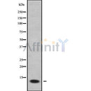 Western blot analysis of ACBD7 using K562 whole cell lysates