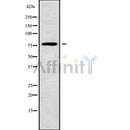 Western blot analysis of ACOX3 using COLO205 whole cell lysates