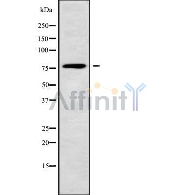 Western blot analysis of ACOX3 using COLO205 whole cell lysates
