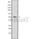 DF9157 at 1/100 staining Mouse kidney tissue by IHC-P. The sample was formaldehyde fixed and a heat mediated antigen retrieval step in citrate buffer was performed. The sample was then blocked and incubated with the antibody for 1.5 hours at 22¡ãC. An HRP conjugated goat anti-rabbit antibody was used as the secondary