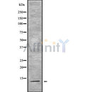 DF9159 staining Hela by IF/ICC. The sample were fixed with PFA and permeabilized in 0.1% Triton X-100,then blocked in 10% serum for 45 minutes at 25¡ãC. The primary antibody was diluted at 1/200 and incubated with the sample for 1 hour at 37¡ãC. An  Alexa Fluor 594 conjugated goat anti-rabbit IgG (H+L) Ab, diluted at 1/600, was used as the secondary antibod