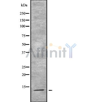 DF9159 staining Hela by IF/ICC. The sample were fixed with PFA and permeabilized in 0.1% Triton X-100,then blocked in 10% serum for 45 minutes at 25¡ãC. The primary antibody was diluted at 1/200 and incubated with the sample for 1 hour at 37¡ãC. An  Alexa Fluor 594 conjugated goat anti-rabbit IgG (H+L) Ab, diluted at 1/600, was used as the secondary antibod