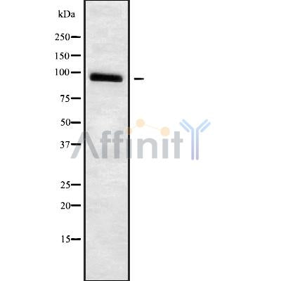 Western blot analysis of ADAM23 using Jurkat whole cell lysates