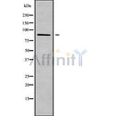 Western blot analysis of ADAM28 using COLO205 whole cell lysates