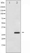 AF3080 staining HeLa by IF/ICC. The sample were fixed with PFA and permeabilized in 0.1% Triton X-100,then blocked in 10% serum for 45 minutes at 25¡ãC. The primary antibody was diluted at 1/200 and incubated with the sample for 1 hour at 37¡ãC. An  Alexa Fluor 594 conjugated goat anti-rabbit IgG (H+L) Ab, diluted at 1/600, was used as the secondary antibod