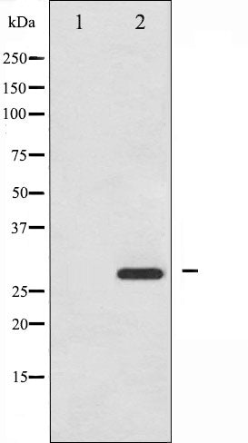 AF3080 staining HeLa by IF/ICC. The sample were fixed with PFA and permeabilized in 0.1% Triton X-100,then blocked in 10% serum for 45 minutes at 25¡ãC. The primary antibody was diluted at 1/200 and incubated with the sample for 1 hour at 37¡ãC. An  Alexa Fluor 594 conjugated goat anti-rabbit IgG (H+L) Ab, diluted at 1/600, was used as the secondary antibod