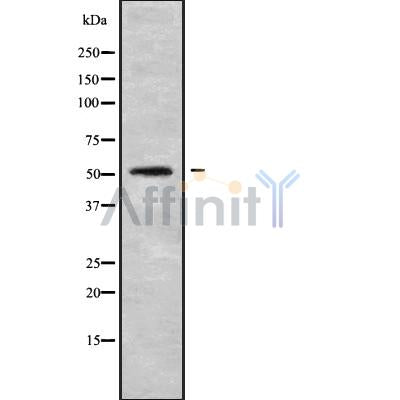 DF9167 at 1/100 staining Mouse colon tissue by IHC-P. The sample was formaldehyde fixed and a heat mediated antigen retrieval step in citrate buffer was performed. The sample was then blocked and incubated with the antibody for 1.5 hours at 22¡ãC. An HRP conjugated goat anti-rabbit antibody was used as the secondary