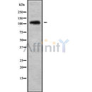 DF9168 at 1/100 staining Mouse kidney tissue by IHC-P. The sample was formaldehyde fixed and a heat mediated antigen retrieval step in citrate buffer was performed. The sample was then blocked and incubated with the antibody for 1.5 hours at 22¡ãC. An HRP conjugated goat anti-rabbit antibody was used as the secondary
