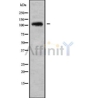DF9168 at 1/100 staining Mouse kidney tissue by IHC-P. The sample was formaldehyde fixed and a heat mediated antigen retrieval step in citrate buffer was performed. The sample was then blocked and incubated with the antibody for 1.5 hours at 22¡ãC. An HRP conjugated goat anti-rabbit antibody was used as the secondary
