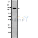Western blot analysis of ADAMTS10 using HuvEc whole cell lysates