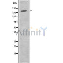 Western blot analysis of ADAMTS12 using HuvEc whole cell lysates