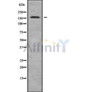 DF9171 at 1/100 staining Human melanoma tissue by IHC-P. The sample was formaldehyde fixed and a heat mediated antigen retrieval step in citrate buffer was performed. The sample was then blocked and incubated with the antibody for 1.5 hours at 22¡ãC. An HRP conjugated goat anti-rabbit antibody was used as the secondary