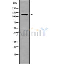 DF9172 at 1/100 staining Human lung cancer tissue by IHC-P. The sample was formaldehyde fixed and a heat mediated antigen retrieval step in citrate buffer was performed. The sample was then blocked and incubated with the antibody for 1.5 hours at 22¡ãC. An HRP conjugated goat anti-rabbit antibody was used as the secondary