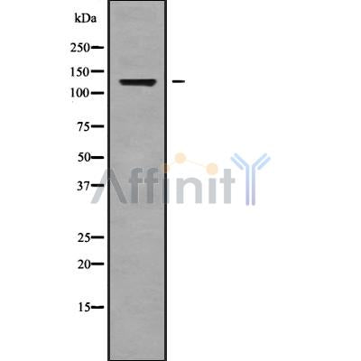 DF9172 at 1/100 staining Human lung cancer tissue by IHC-P. The sample was formaldehyde fixed and a heat mediated antigen retrieval step in citrate buffer was performed. The sample was then blocked and incubated with the antibody for 1.5 hours at 22¡ãC. An HRP conjugated goat anti-rabbit antibody was used as the secondary