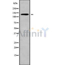 Western blot analysis of ADAMTS16 using HuvEc whole cell lysates