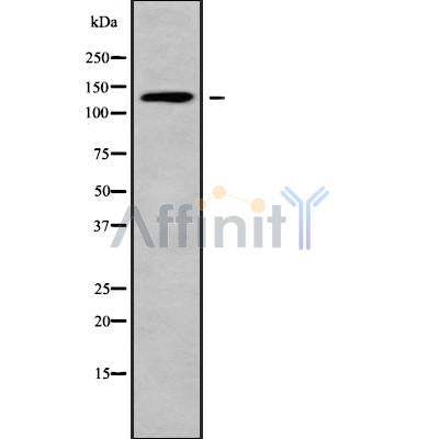 Western blot analysis of ADAMTS16 using HuvEc whole cell lysates